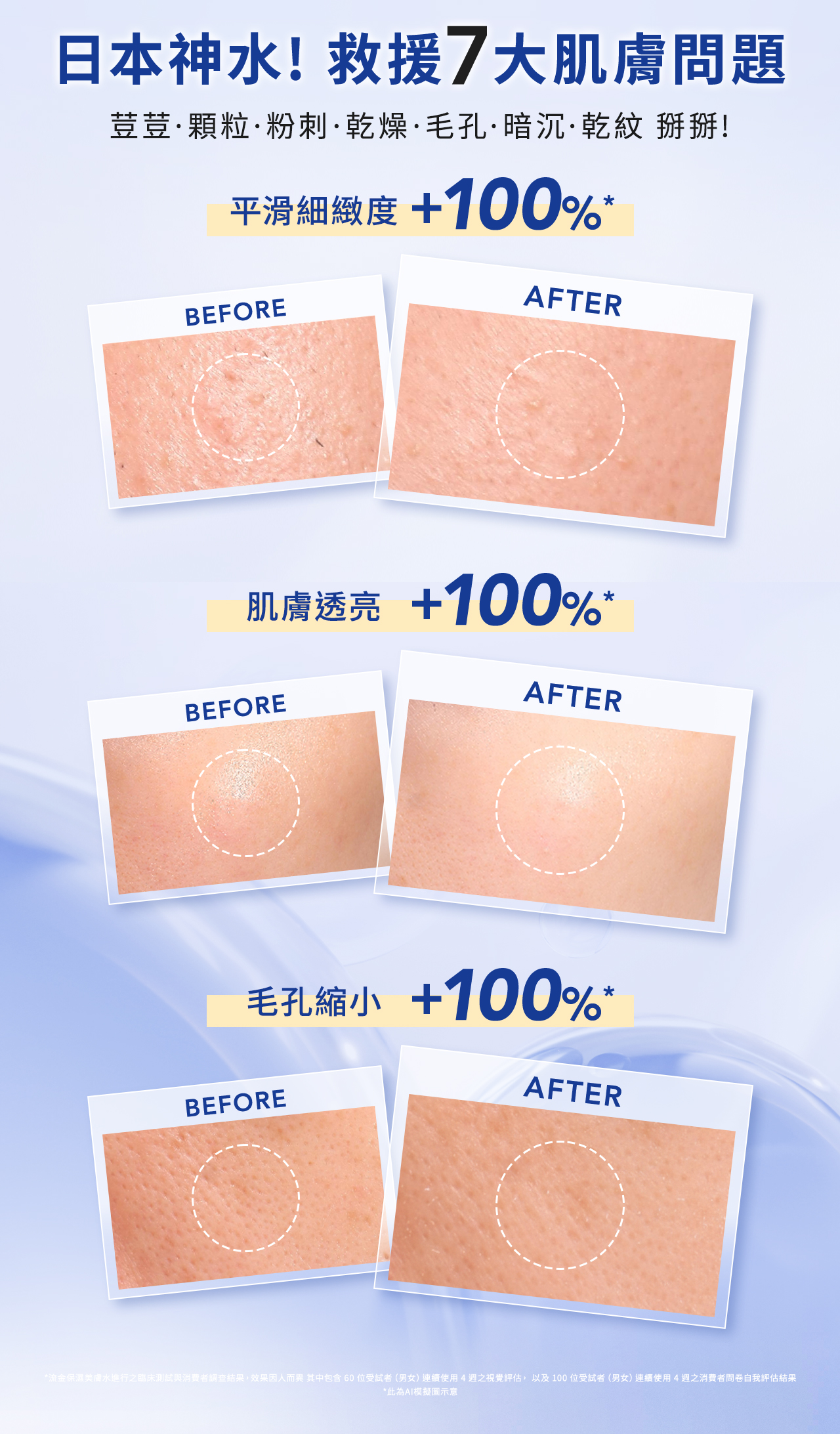 日本神水!救援7大肌膚問題
荳荳·顆粒·粉刺·乾燥·毛孔·暗沉·乾紋掰掰!